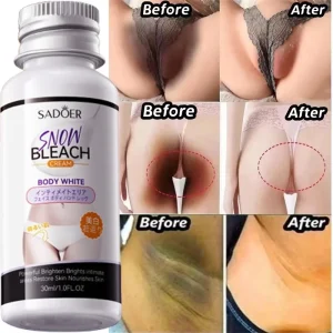 Whitening Cream Private Parts Underarm Bleaching